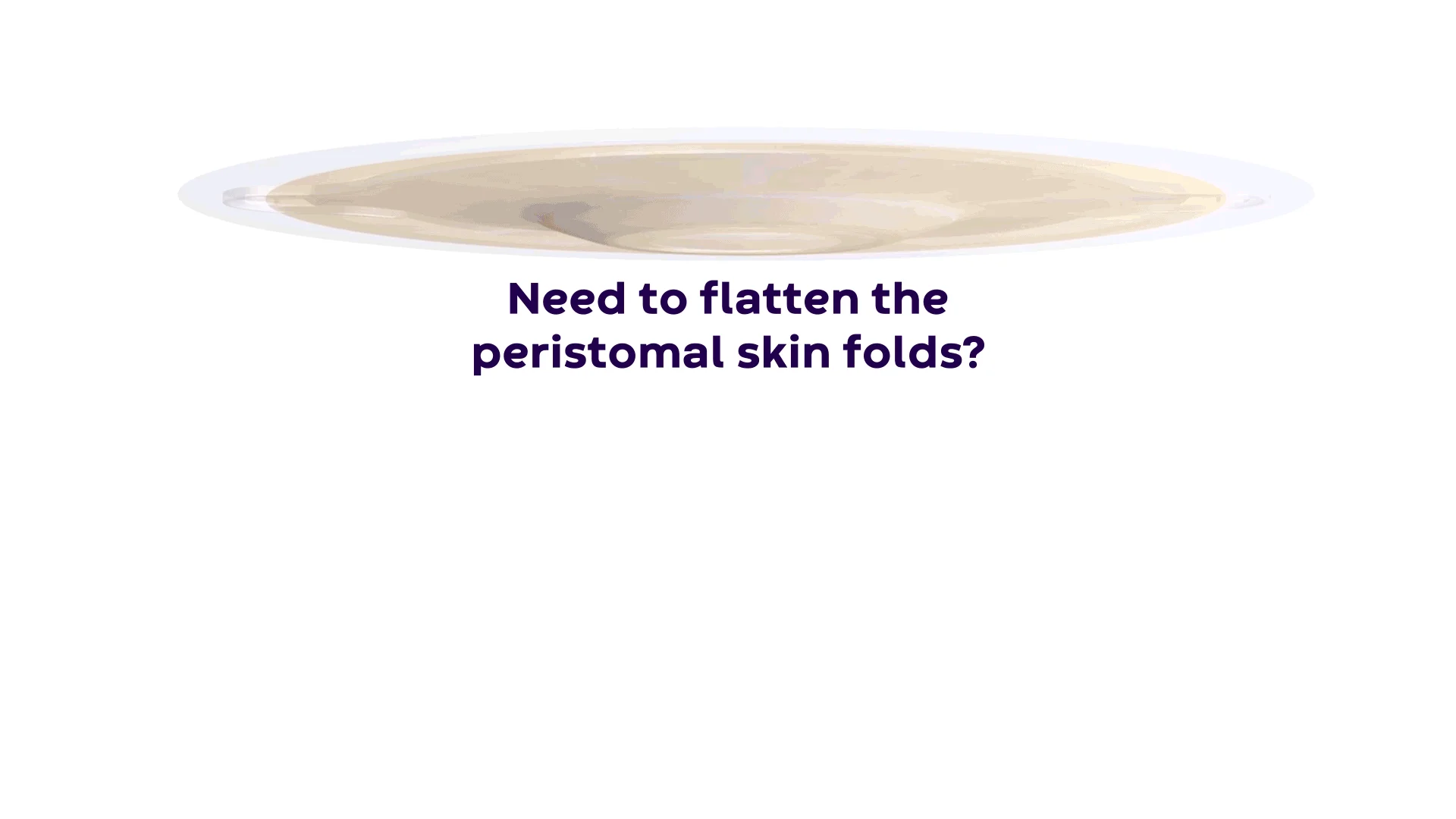 Un video que explica la tensión periférica para aplanar los pliegues de la piel periestomal para un sellado de ostomía confiable.