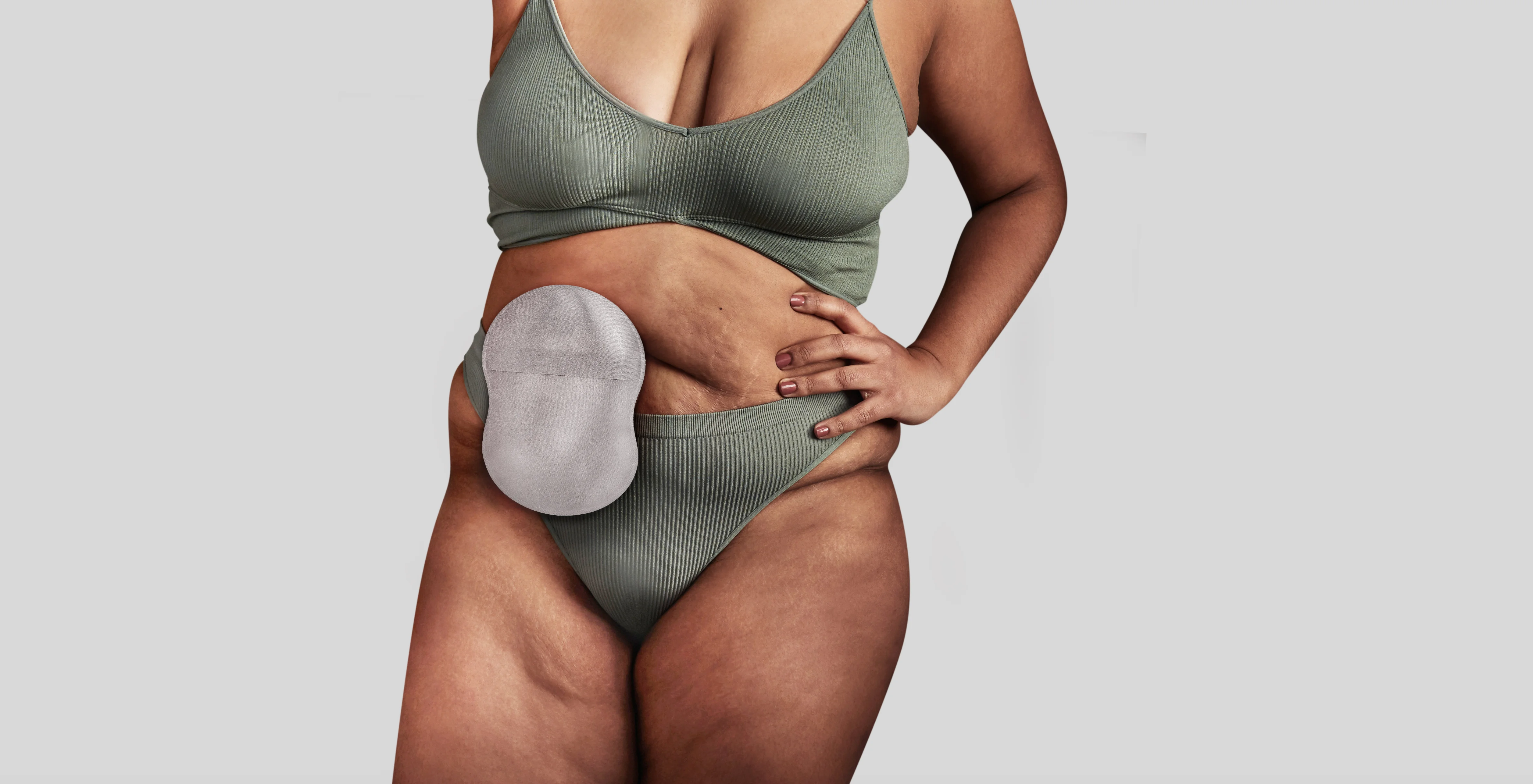 Frau trägt ein Stoma Esteem Body™ Beutel